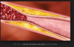 benzericerikler-2.JPG